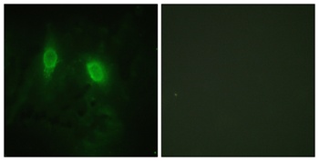 IKKγ rabbit pAb Antibody