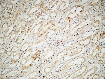 IL2 Rabbit Polyclonal Antibody
