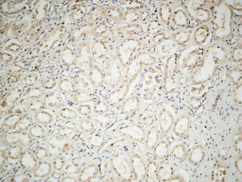 IL2 Rabbit Polyclonal Antibody