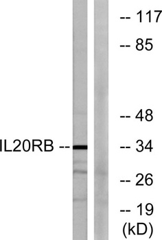 IL-20Rβ rabbit pAb Antibody