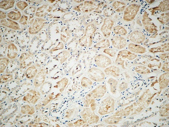 Integrin αV rabbit pAb Antibody