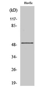 IP3KA rabbit pAb Antibody