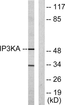 IP3KA rabbit pAb Antibody