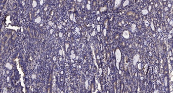 IP3KA rabbit pAb Antibody