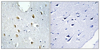 IRF-4 rabbit pAb Antibody