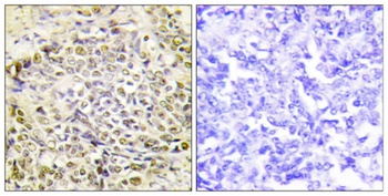 IRX2 rabbit pAb Antibody