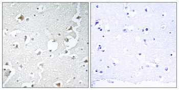JIP-1 rabbit pAb Antibody