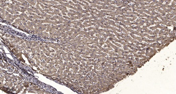 JMY rabbit pAb Antibody