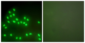 Ku-80 rabbit pAb Antibody