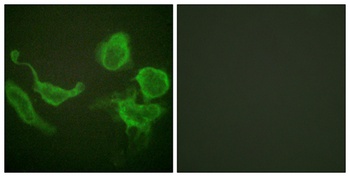 Kv3.4 rabbit pAb Antibody