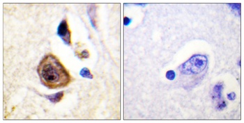 Kv3.4 rabbit pAb Antibody