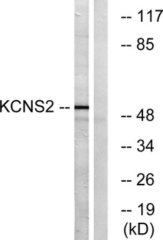 KV9.2 rabbit pAb Antibody