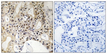LATS1/2 rabbit pAb Antibody