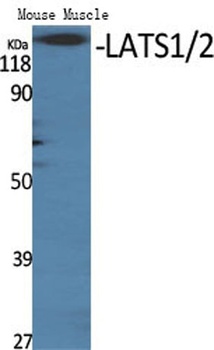 LATS1/2 rabbit pAb Antibody
