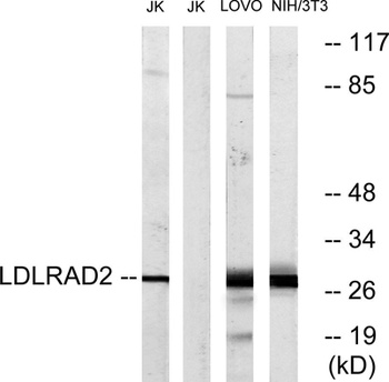 LDLRAD2 rabbit pAb Antibody