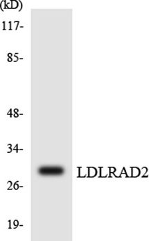 LDLRAD2 rabbit pAb Antibody