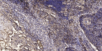 LDLRAD2 rabbit pAb Antibody