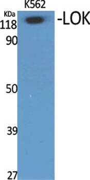 LOK rabbit pAb Antibody