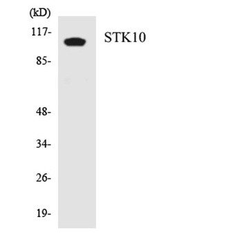 LOK rabbit pAb Antibody