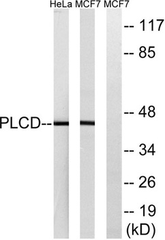 LPAAT-δ rabbit pAb Antibody