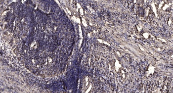 LPAAT-δ rabbit pAb Antibody