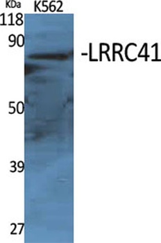 LRRC41 rabbit pAb Antibody