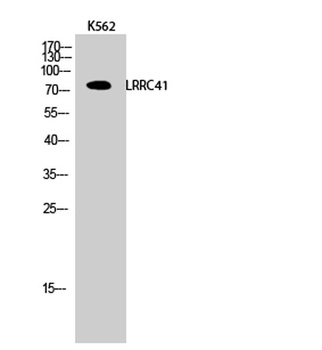 LRRC41 rabbit pAb Antibody