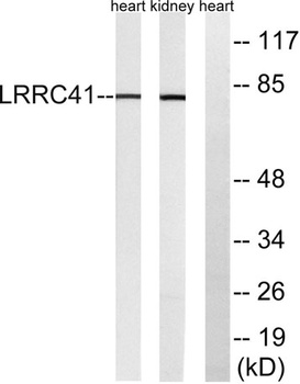 LRRC41 rabbit pAb Antibody
