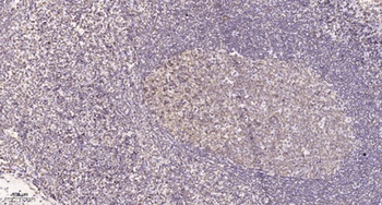 LRRC41 rabbit pAb Antibody