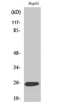 LT-β rabbit pAb Antibody