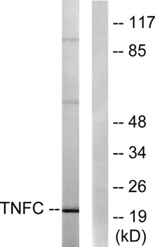 LT-β rabbit pAb Antibody
