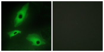 LTβR rabbit pAb Antibody