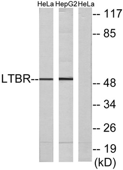 LTβR rabbit pAb Antibody
