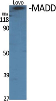 MADD rabbit pAb Antibody