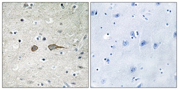 MADD rabbit pAb Antibody