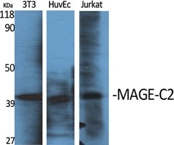 MAGE-C2 rabbit pAb Antibody