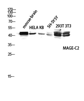 MAGE-C2 rabbit pAb Antibody