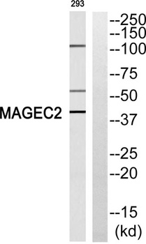 MAGE-C2 rabbit pAb Antibody