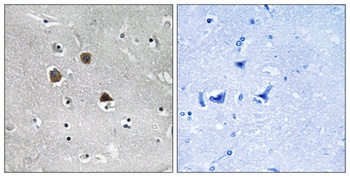 MARK1/2/3/4 rabbit pAb Antibody
