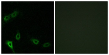 MARK2 rabbit pAb Antibody