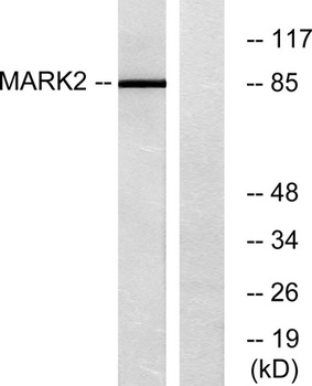 MARK2 rabbit pAb Antibody