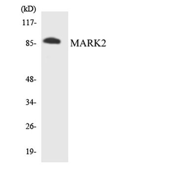 MARK2 rabbit pAb Antibody