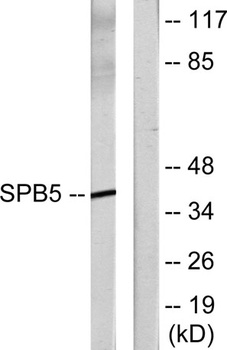 Maspin rabbit pAb Antibody