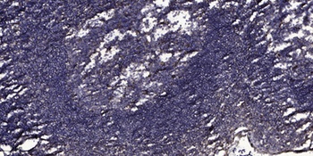 Maspin rabbit pAb Antibody