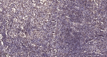 Mat1 rabbit pAb Antibody