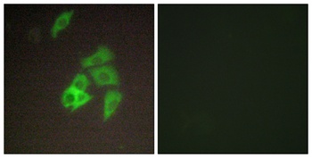 Matriptase rabbit pAb Antibody