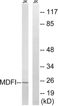 MDFI rabbit pAb Antibody