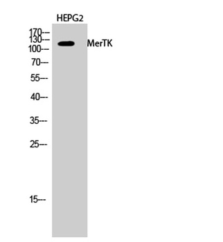 MerTK rabbit pAb Antibody