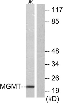 MGMT rabbit pAb Antibody