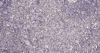 MGMT rabbit pAb Antibody